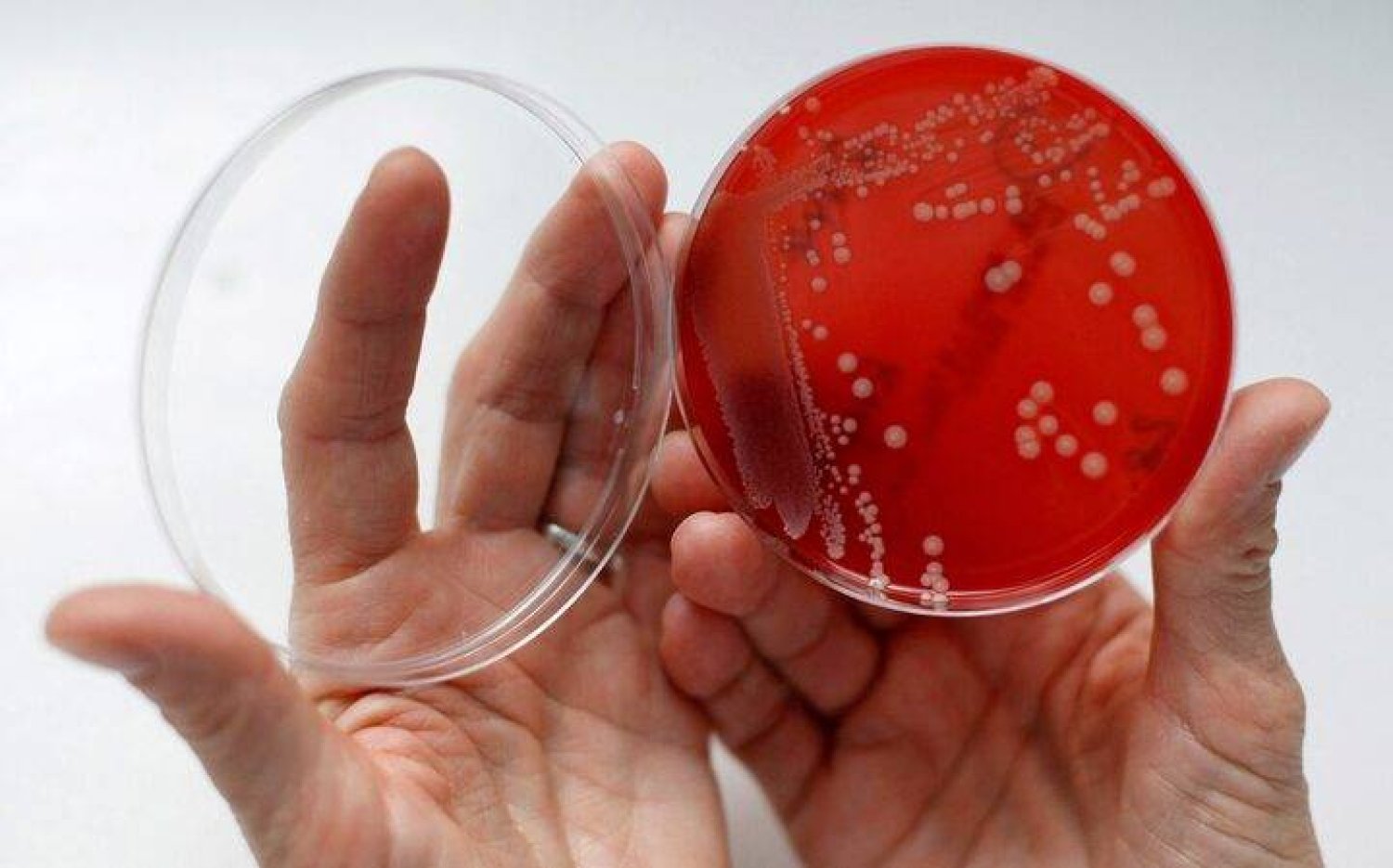 ارتفاع الحرارة يعزّز قدرة البكتيريا على البقاء حيّة (رويترز)