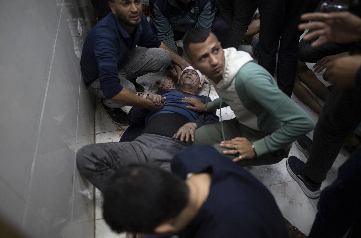جريح يرقد على الأرض في مستشفى ناصر في خان يونس جنوب قطاع غزة الأحد (إ.ب.أ)