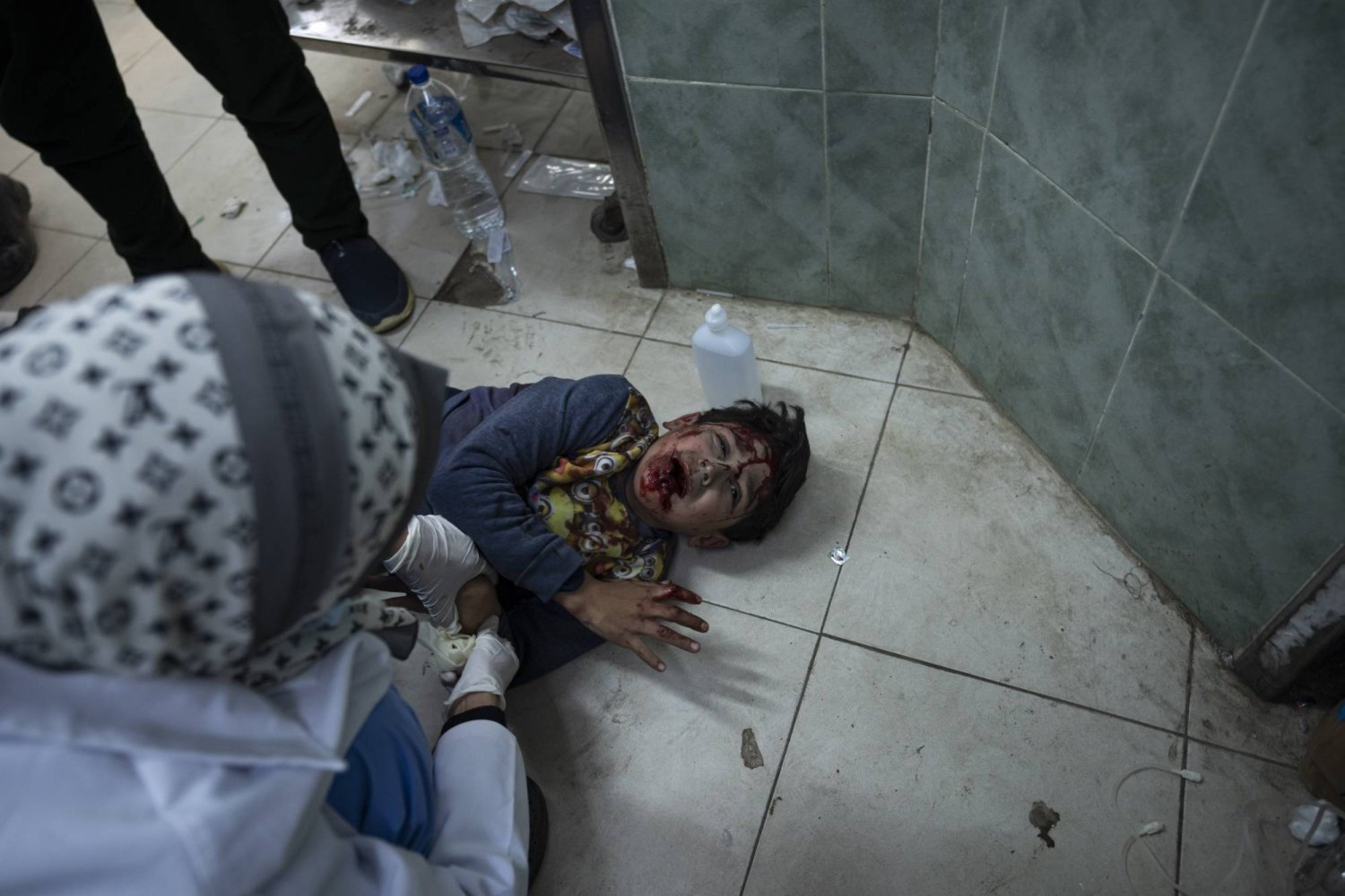 طفل جريح نتيجة قصف إسرائيلي بمستشفى «النجار» في رفح (أ.ب)