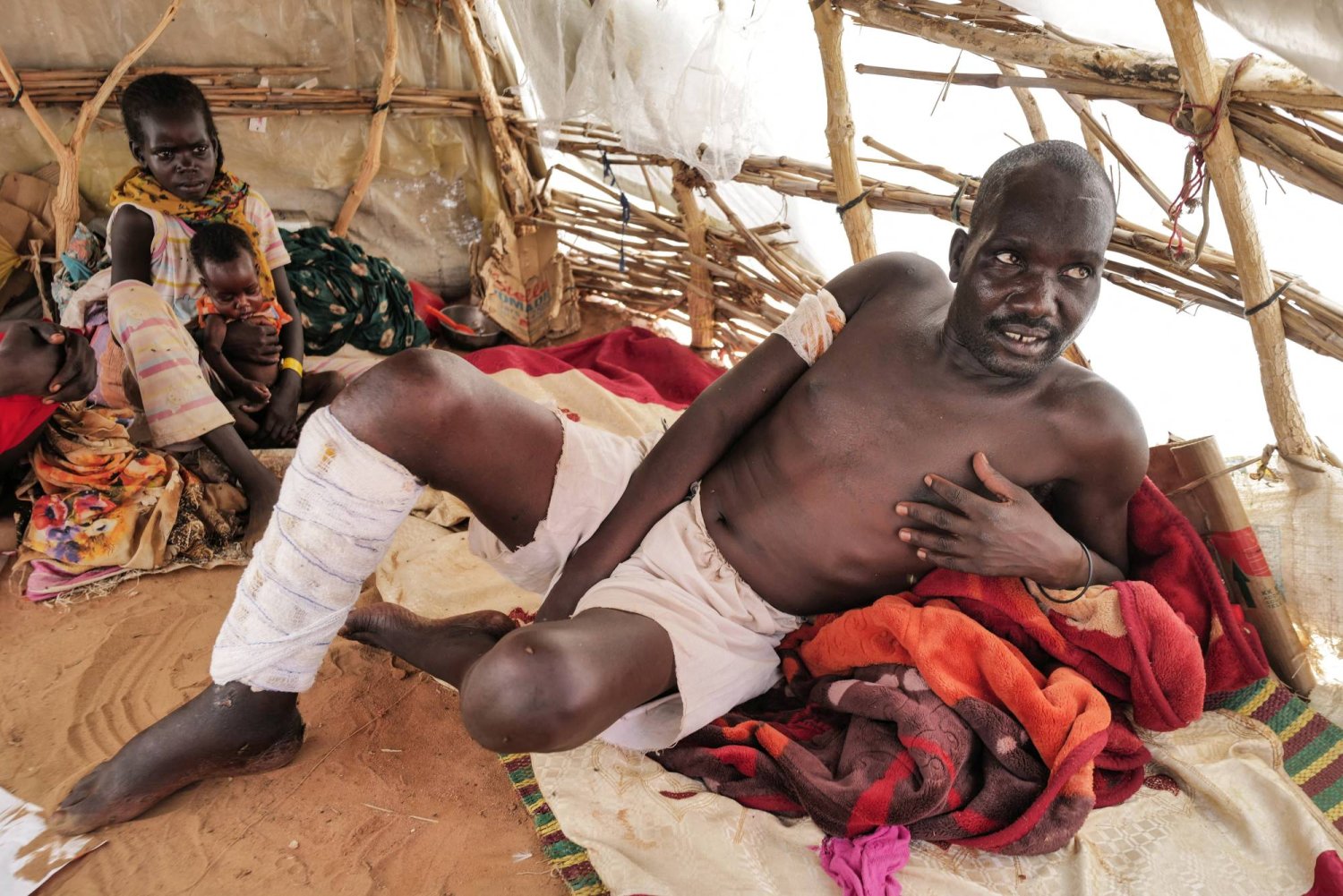 مصاب سوداني تظاهر بالموت لينجو من هجوم لـ«الدعم السريع» على مستشفى كان يعالج فيه (رويترز)