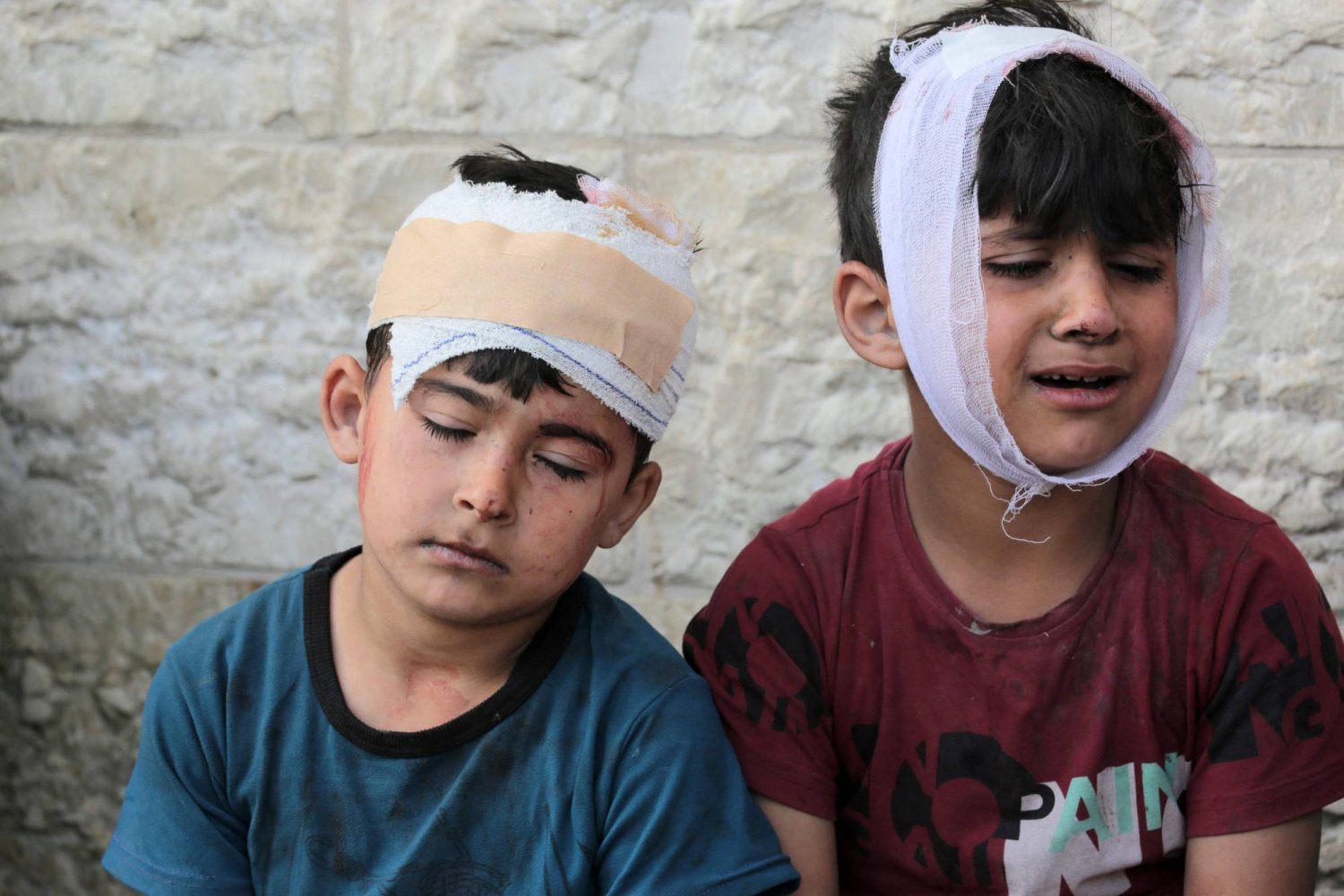 أطفال فلسطينيون جرحى نتيجة الغارات الإسرائيلية في مستشفى شهداء الأقصى في دير البلح بقطاع غزة اليوم (أ.ف.ب)